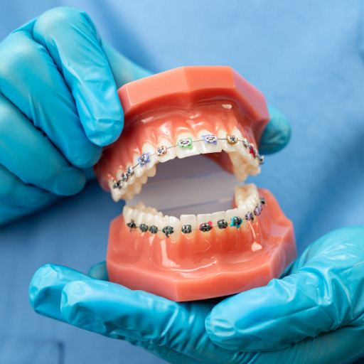 Ortodoncia dental